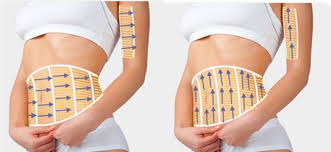 hifu body